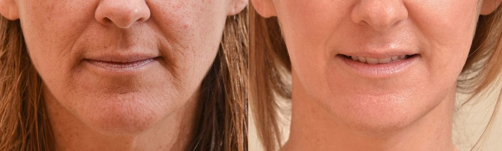 نتایج-استفاده-از-سرم-آسکوربیک-اسید-اوردینری