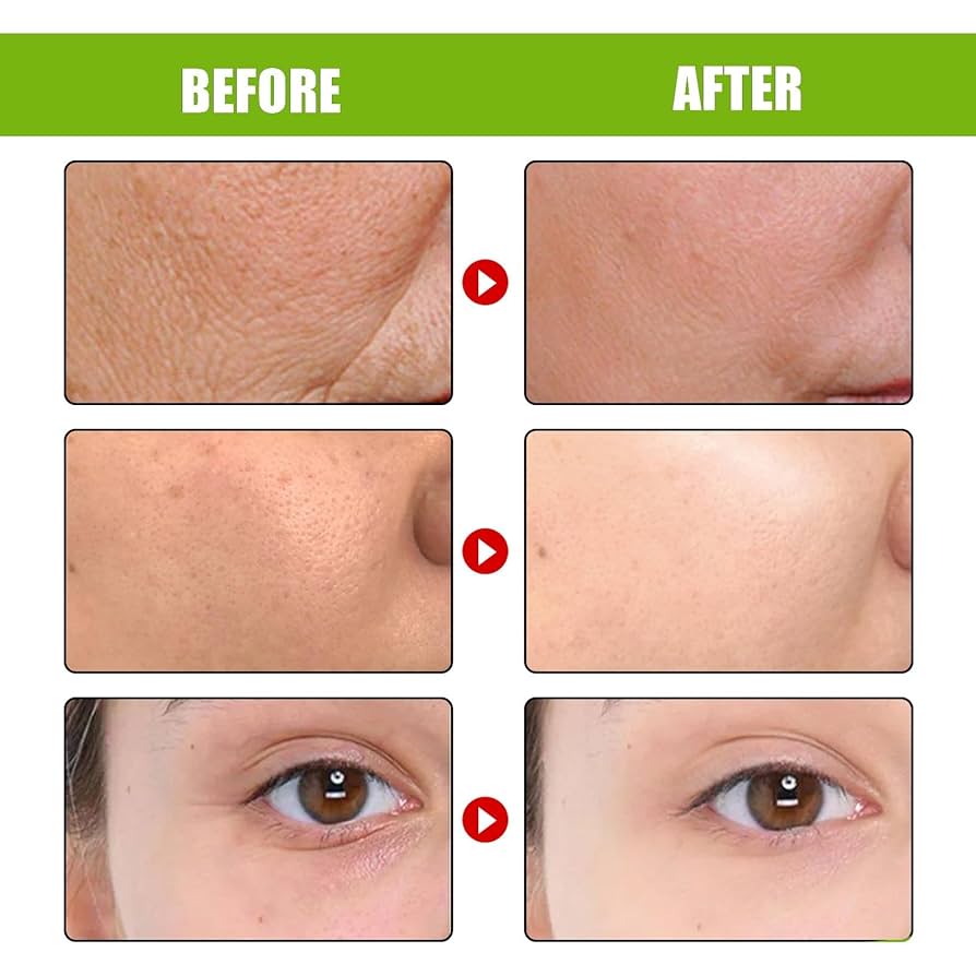 کرم رتینال شات سلیمکس Celimax حجم 15 میل
